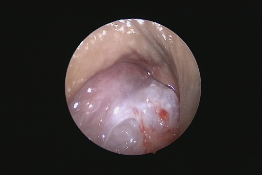 careold